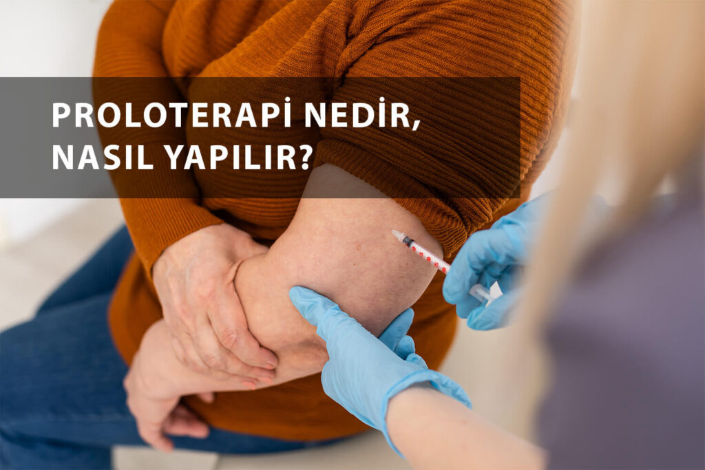 Proloterapi Nedir, Nasıl Yapılır?