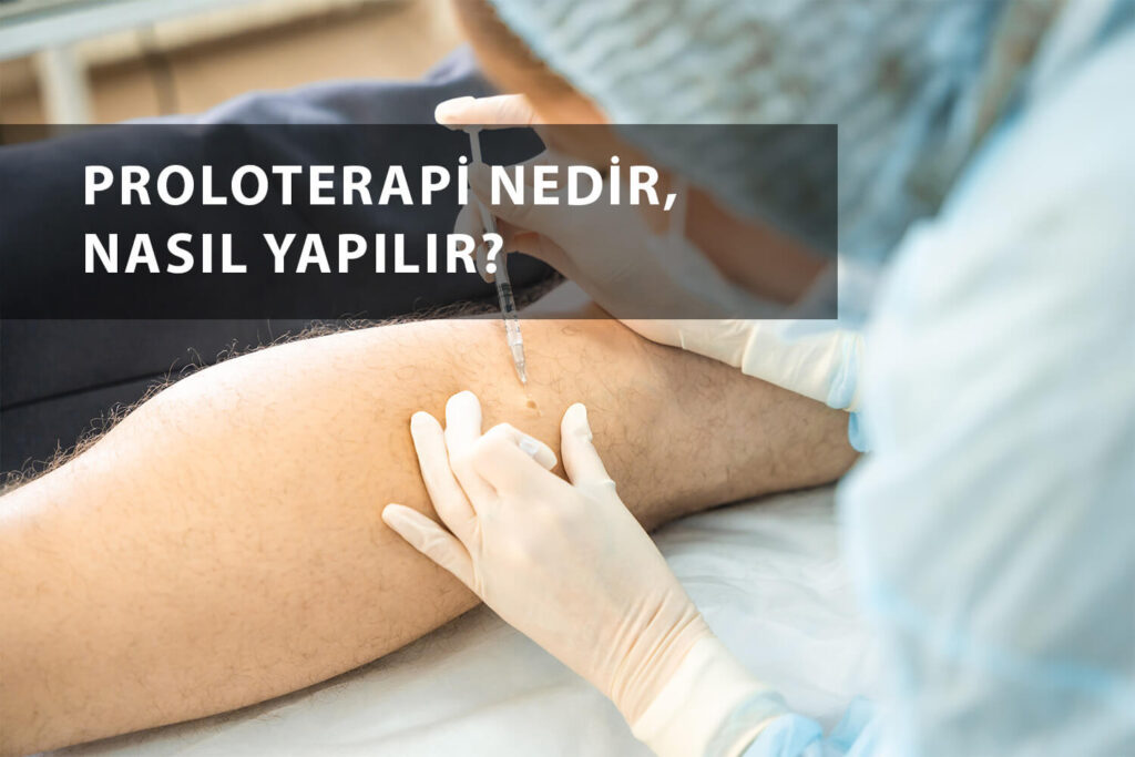 Diz Sıvısı İğnesi Nedir?